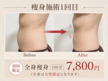 エヌ(N)