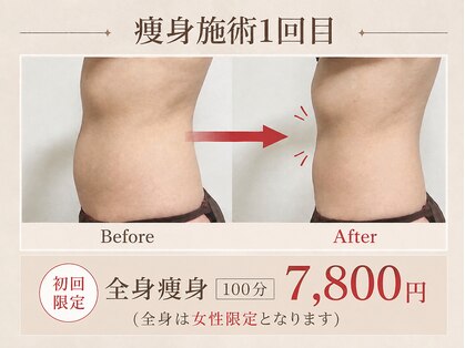 エヌ(N)の写真