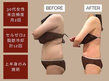 ベベティー(BEBETIE)
