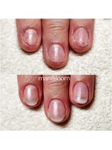 マニブルーム/深爪矯正/長さ出し