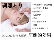 ココラーレ(cocorare)/日暮里/剥離あり本気の肌質改善