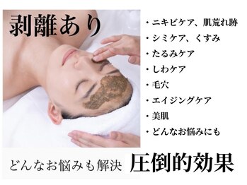 ココラーレ(cocorare)/日暮里/剥離あり本気の肌質改善