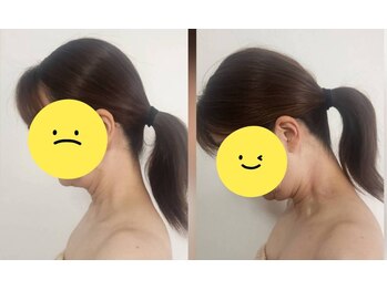 スマイリー(smiley)/可動域が改善