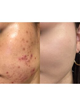 お肌をきれいにしたい