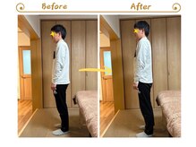 アイノテ メディカルボディケア(Ainote medical body care)/［首・肩こりの施術例紹介］