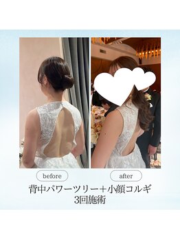 エスプレッソ(espresso,)/【挙式1ヶ月前】駆け込みエステ