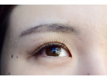 カランテ(CALANTE)/２．After/300本