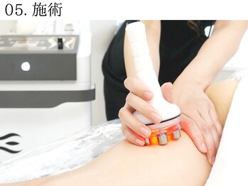 リヴィ(Levi)/施術