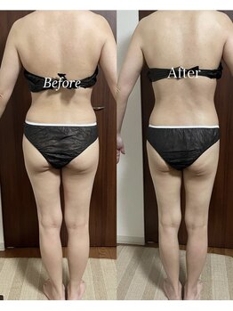 ヴィム(VIM)/ハイパーナイフビフォーアフター