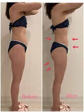 スペチアーレ 夙川/赤字価格の22,000円でお悩み解消