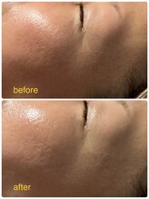 えすて処 灯香/before/aftre 目元ケア