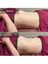 ミースリーズ(methrees)/衝撃★お腹のDIET【腸もみ】