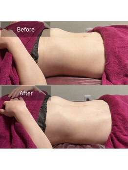 ミースリーズ(methrees)/衝撃★お腹のDIET【腸もみ】