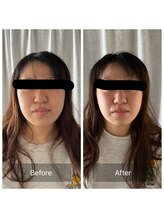 マハロ 海老名店(Mahalo)/小顔矯正　20代女性