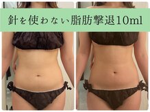 ソルニスデュオ(Solnis.-duo-)/痩身/酵素浴/毛穴/よもぎ蒸し