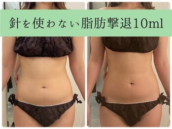 ソルニスデュオ(Solnis.-duo-)/痩身/酵素浴/毛穴/よもぎ蒸し