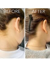 ビオトーン バイ ツリー(biotone by TREE)/うなじ/Wax脱毛/ワックス脱毛