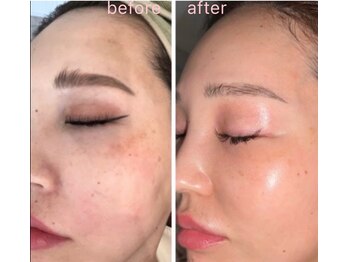 プリマ 大津店(PRIMA)/話題の韓国発トリートメント☆