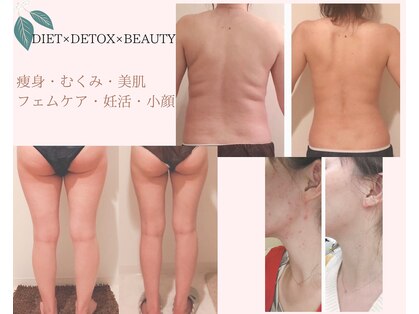 ヨサパーク ル フェルナ(YOSA PARK Le Ferna)の写真