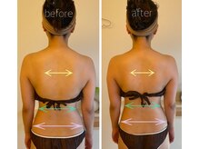 パル コルギサロン(Pal. Korugi salon)/コルギビフォーアフター