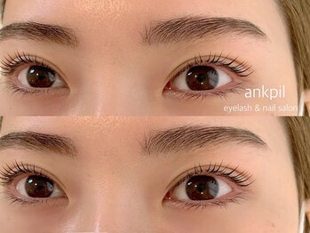 アノカプイル(ankpil)/【お得に垢抜けセット】