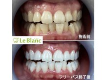 ルブラン 奈良店(Le Blanc)/3週間通い放題！
