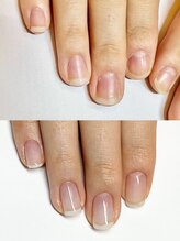 マリーロール 梅田店(Marie Laure)/自爪育成/深爪矯正/ネイルケア