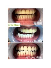 ルブラン 奈良店(Le Blanc)/メンテナンスが大切です！