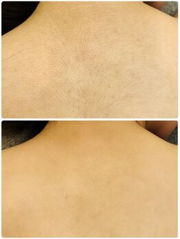 アールイー(Re:)/