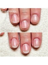 マニブルーム/深爪矯正/長さ出し