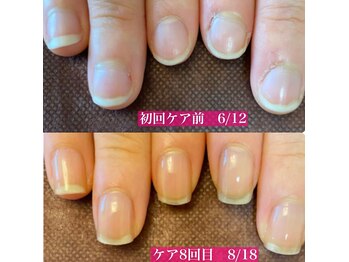 クーラ アンド ベリッシモ(Cura&Bellissimo)