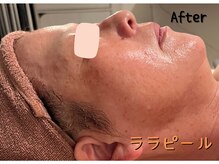 ダイヤモンド リーエンダ(Diamond leende)/ララピール