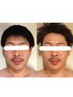 【メンズ限定】眼精疲労/頭痛改善☆炭酸orドライへッドスパ60分¥17000→¥7800