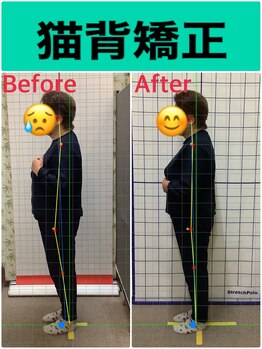 しんりふ接骨院/猫背矯正