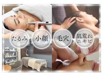 シェノン(Chainon)