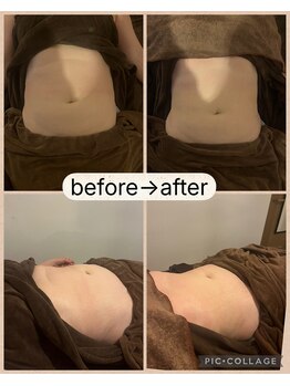 アネクル(ANECUL)/