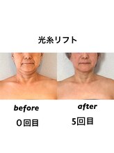 アトリエドゥアージュ(Atelier de age)