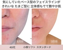 リアン(Lien)
