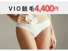 【脱毛】レディースVIO脱毛 ¥4,400