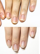 マリーロール 梅田店(Marie Laure)/自爪育成/深爪矯正/ネイルケア