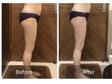 アランチャンティック(AlamCantik)/インド　EMSキャビ