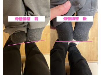 ボディステップ(BODY STEP)/骨盤調整で足の長さ調整