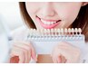 セルフホワイトニング 1回 ¥3,000→¥2,000
