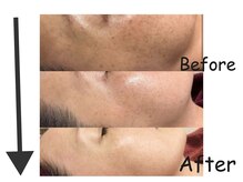 エステ ド あーと/ before/after