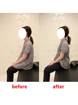 ナオル整体 福岡香椎院(NAORU整体)/20代女性施術事例【猫背】