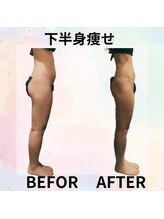 サロンド ヴィーナス 葛西店/ヒップ痩せ★美脚へのアプローチ