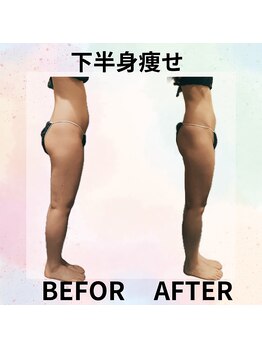 サロンド ヴィーナス 葛西店/ヒップ痩せ★美脚へのアプローチ