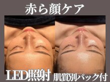 マヴィ 香里園店(MavY.)の雰囲気（毛穴洗浄/小顔/ハーブピーリング/フェイシャル/寝屋川/香里園）