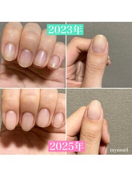 たゆ ネイル(たゆnail)/パラジェルで自爪育成♪