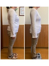 リンドール(RinDoll)/50代女性ダイエット/耳ツボ/痩身